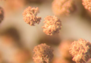 Types of Mold to Watch For in Homes: Top 7 Places Where Mold Grows